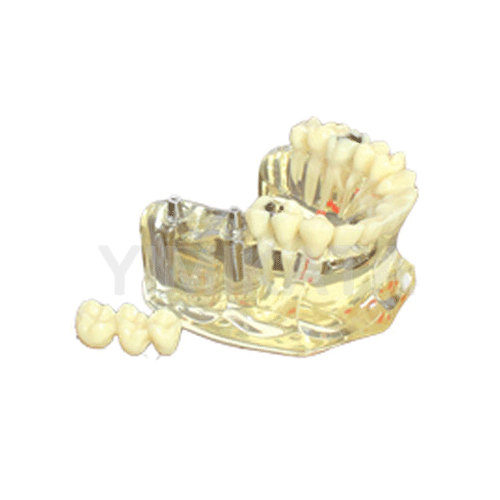 Modelo de enseñanza, Consumibles dentales, material dental, clinica dental, dent